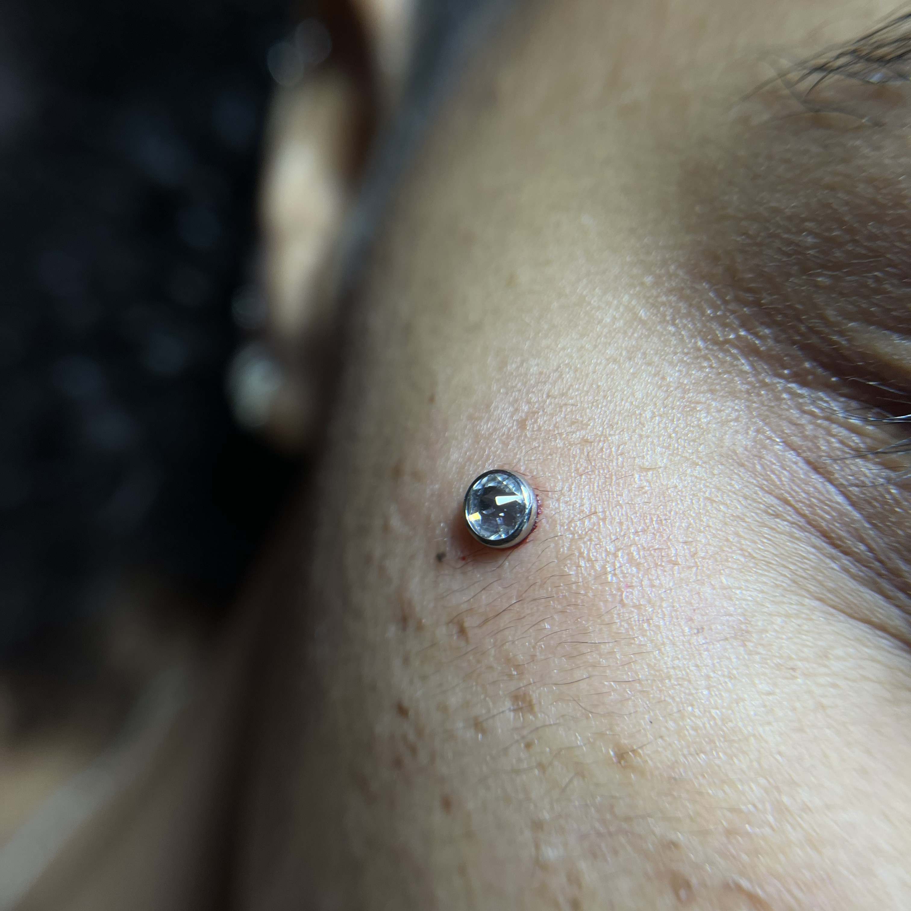 Microdermal facial com joia de cristal